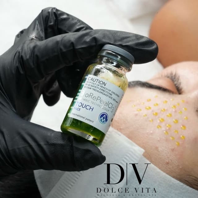 BioRePeel Face Only - 4